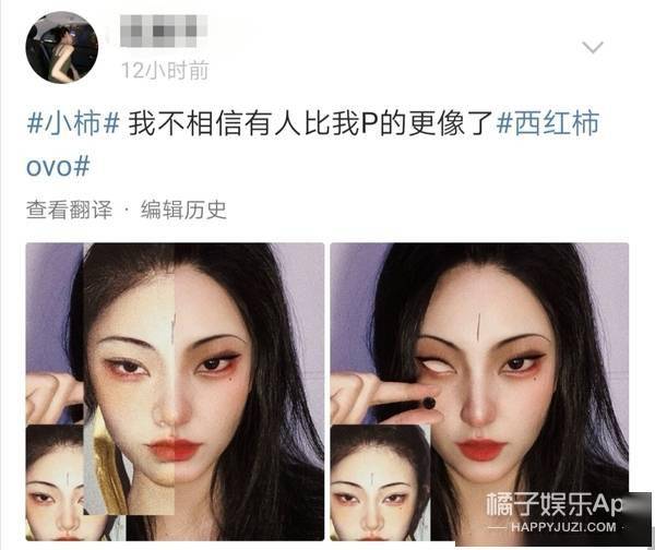 童颜针一个月后效果图，重塑美丽新面貌