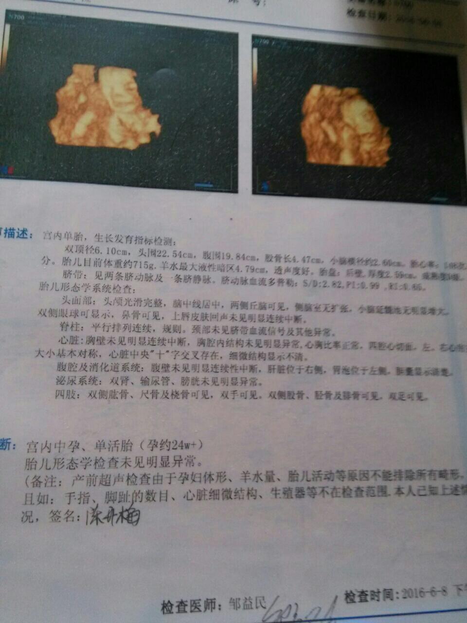 关于五个月能否确定胎儿性别的探讨